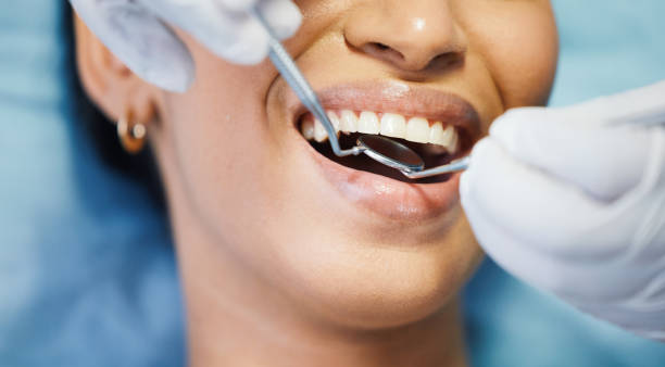 Best Knocked-Out Tooth (Avulsed Tooth) Treatment in Greensburg, KY