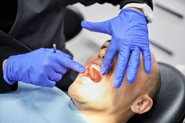 Best Broken or Chipped Tooth Repair in Greensburg, KY